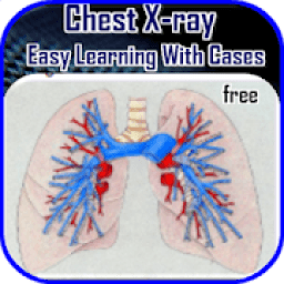 ikon Chest X-ray Easy Learning