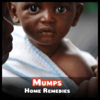 Home Remedies for Mumps - Mumps treatment