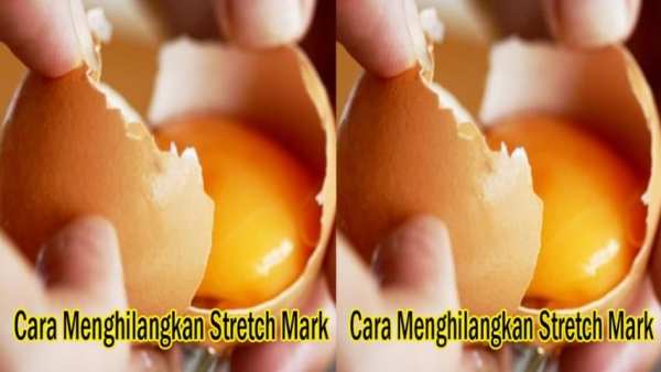How to Get Rid of Mark Stretch screenshot 1