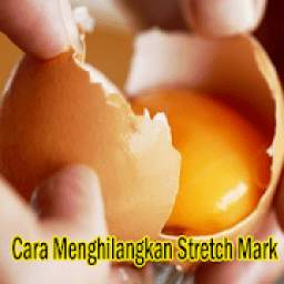 Stretch Mark 1.0