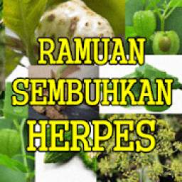 Ramuan Herbal Penyakit Herpes