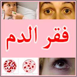 أعراض فقر الدم 2.0