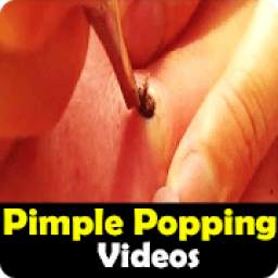 Best Pimple Popping Videos - Remove Blackheads