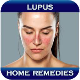 Home Remedies For Lupus