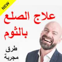 علاج الصلع بالثوم
‎