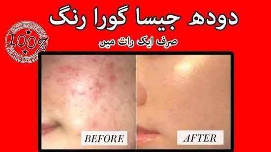 Beauty tips in urdu स्क्रीनशॉट 3