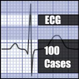 ECG 100 Clinical Cases