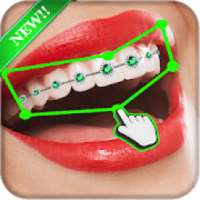 Add braces to your teeth on 9Apps