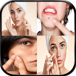 أفضل الوصفات لإزالة حب الشباب
‎ icon