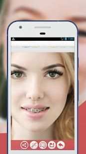 Braces Teeth Photo Editor screenshot 4