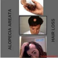 Alopecia / Hair Loss