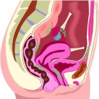 Heavy Menstrual Bleeding