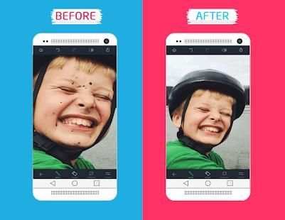 Retouch, Remove Unwanted Content for Touch-Retouch screenshot 1