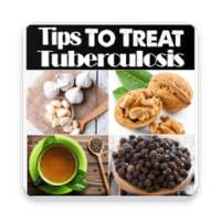 Tips To Treat Tuberculosis on 9Apps