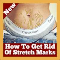 How To Get Rid Of Stretch Mark With Home Remedies on 9Apps