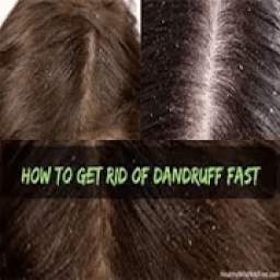 Get Rid Of Dandruff