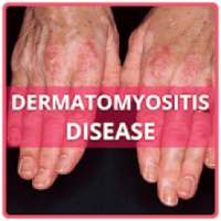 Dermatomyositis Disease on 9Apps