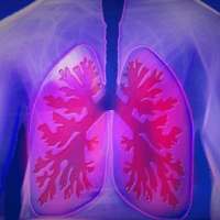 Essential Facts About Lung Cancer - bloody mucus