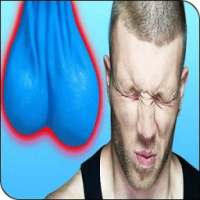 Blue Balls (Epididymal hypertension)