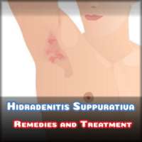 Hidradenitis Suppurativa natural treatment on 9Apps