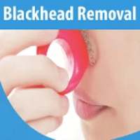Blackhead Removal on 9Apps