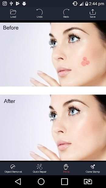 Photo Retouch - Blemish Remove स्क्रीनशॉट 4