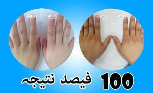 Rang gora karne ki tips in urdu screenshot 2