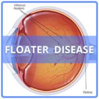 Floater Disease