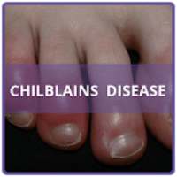 Chilblains Disease