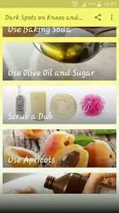 Get Rid Of Dark Knees And Elbows Fast & Naturally screenshot 4