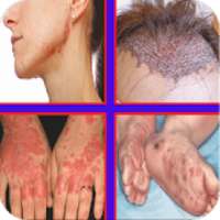 All Skin Disease and Treatment complete on 9Apps