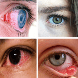 Eye Diseases And Treatments icon