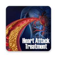 Heart Attack Treatment