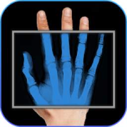 X-Ray Body Scanner Simulation