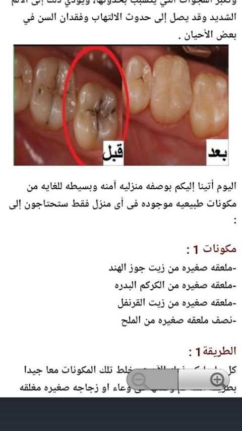 تخلص من تسوس الأسنان في يوم واحد screenshot 2