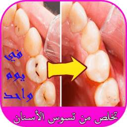 تخلص من تسوس الأسنان في يوم واحد 1.0