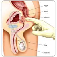 Preguntas Sobre La Próstata