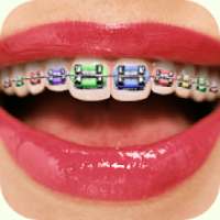 Braces Teeth Editor 2018