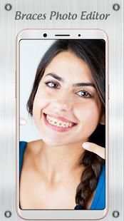 Braces 2018 screenshot 4