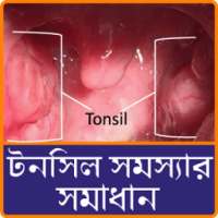 টনসিল দূর: Tonsil Treatment লক্ষণ, ওষুধ ও প্রতিকার on 9Apps