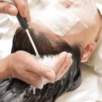 Dry itchy scalp Treatment - Dry scalp remedy