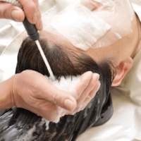 Dry itchy scalp Treatment - Dry scalp remedy on 9Apps