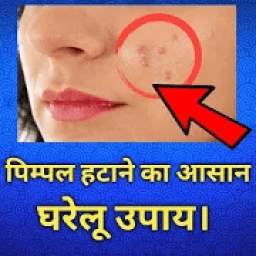 pimple remove tips in hindi