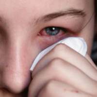 Conjunctivitis Treatment Home Remedies