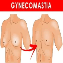 Gynecomastia ( Man Boobs ) आइकन