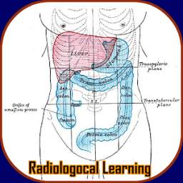 Learn Abdominal Radiological Findings