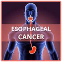 Esophageal Cancer on 9Apps