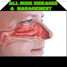 All Nose Diseases And Management