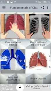 Fundamentals of Chest X-Ray स्क्रीनशॉट 2