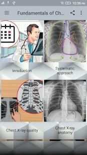 Fundamentals of Chest X-Ray स्क्रीनशॉट 1